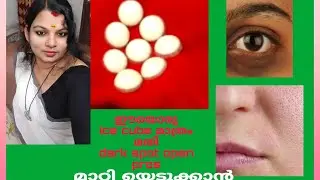 simple home remedy for dark circles and open prose   Btechmixmediatips