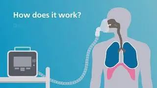 CoughAssist + RespirTech Service Video