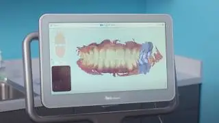 Unlock the full potential of your iTero Element™ 2 scanner