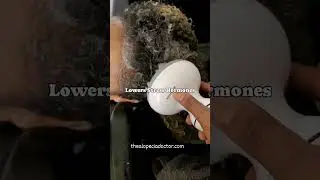 Does s Scalp Massage Help with Hair Growth?? #thealopeciadoctor #Houston #hairloss #scalpcare