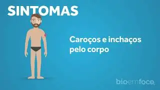 Você Sabia? - Hanseníase