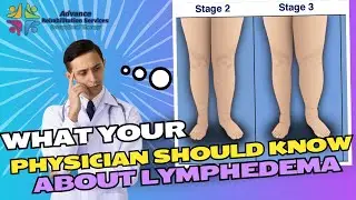10 Things Every Physician Should Know About Lymphedema!