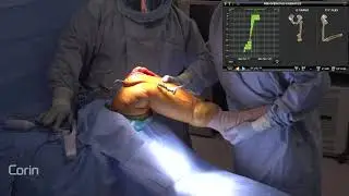 OMNIBotics Surgical Video   Dr. Lawrence -