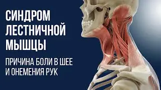 Scalene Muscle Syndrome: The Cause of Neck Pain and Arm Numbness