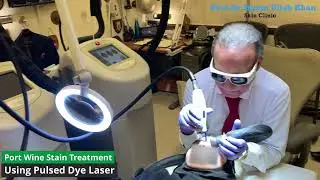 The Power of Pulsed Dye Laser for Port Wine Stains