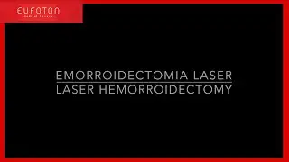 Emorroidectomia laser |  Laser hemorroidecotmy - Dr Francesco  Cantarella [Eufoton®]