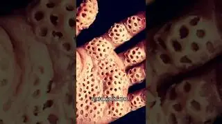 Тест на ТРИПОФОБИЮ | 