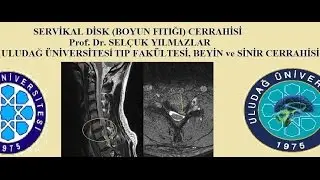 Servikal diskektomi boyun fıtığı cerrahisi   Prof Dr Selçuk Yılmazlar