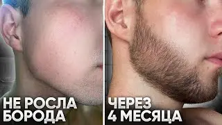 Результаты Ксиноксина для роста бороды / Прошел откат в армии и начал снова