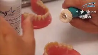 Shine and High Shine Polishing of Acrylic Dentures
