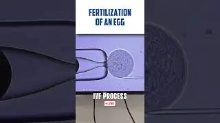 IVF transfer procedure LIVE VIDEO 🔴 Fertilization of Egg & Sperm in Human 