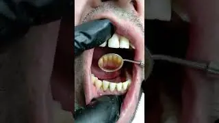 МИЛК ЧУКИШ САБАБИ