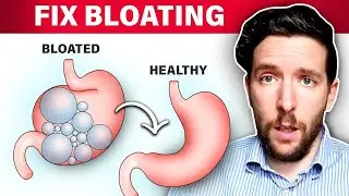 Top 10 Ways To Fix Gas & Bloating (2023)