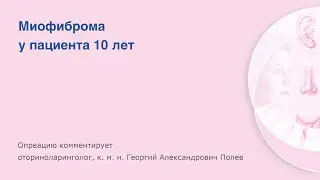 Миофиброма у пациента 10 лет