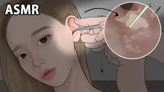 ASMR Hair cleaning in the ear /asmr animation video /Earwax remove