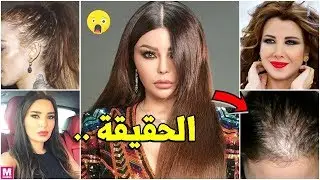 الشعر الحقيقي للنجمات.. لن تصدق ! ! !
