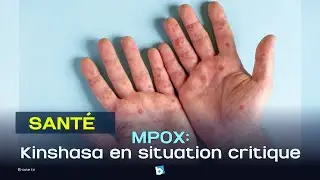🔴LA GRANDE EDITION