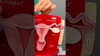 Kürtaj Nasıl Yapılır? - Kürtaj Antalya - Dr. Funda Yazıcı Erol