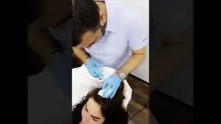Mesotherapy For Hair Growth