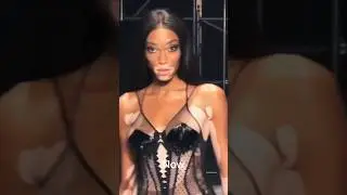 Winnie Harlow Evolution Model #runway #shortsfeed #catwalk #winnieharlow