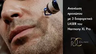 Βελτίωση υφής προσώπου με 3πλό LASER