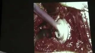 British Trauma Course 11