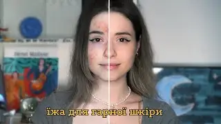 Як позбутися прищів, висипань, харчування для гарної шкіри