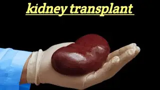 kidney transplant. #educationalvideos #education