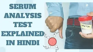 Serum Analysis Test Explained in Hindi || Sperm Test || Sperm Count || Sperm Shape  #spermanalysis