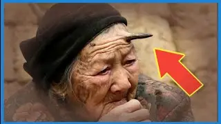 በ80 አመቷ ቀንድ መሳይ ነገር የወጣባት አስገራሚ ሴት-An amazing woman who got a horn at the age of 60#2023#DONKEY TUBE