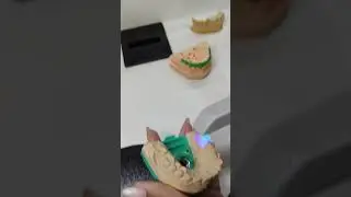Scanner Intraoral Runyes IOS 11 - Dental Prótese / DPF