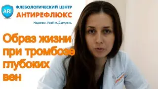 тромбоз глубоких вен лечение и образ жизни
