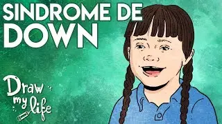 DOWN SYNDROME I What is it? I Draw My Life