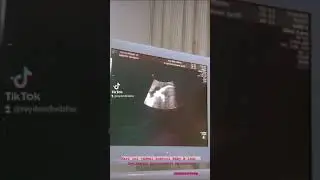AKHIRNYA JADWAL KETEMU BABY A "REY MBAYANG & DINDA HAUW" 🤗