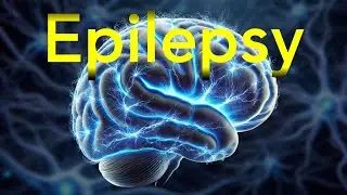 Epilepsy Explained by a Neuroscientist (Real Seizure Footage)