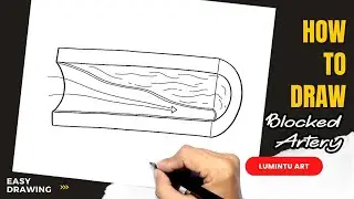 How to draw Blocked Artery - Easy Blocked Artery Drawing