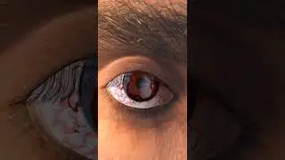Yet Another Realistic Uchiha Madara Mangekyou Sharingan in REAL LIFE: No 2D Overlay, 3D Eye and Iris