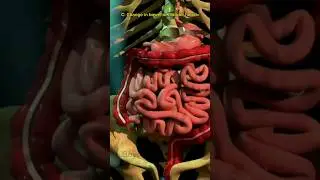 Colon Cancer 