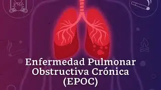 EPOC