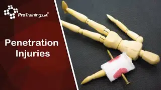 Penetration injuries