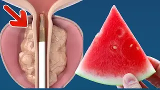 خیلی ها هندوانه زیاد میخورند اما نمیدانند با خوردن هندوانه چه تغیراتی در بدن پیدا میشه ...