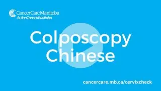 Colposcopy: Chinese