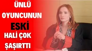 Yargı'nın Neva'sı Başak Gümülcinelioğlu'nun estetiksiz hali şaşırttı.
