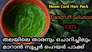 താരൻ പൂർണമായും പോവാൻ //Itchy Scalp Treatment at Home#dandruff