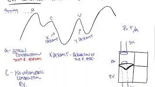 CVP Tracing