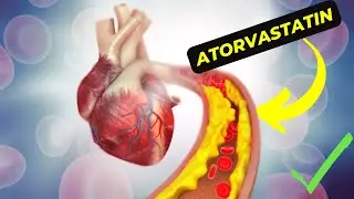 Atorvastatin:. How This Cholesterol-Lowering Medication Can Transform Your Health