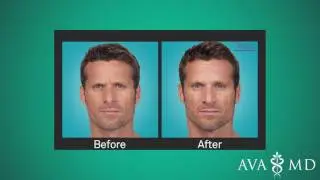 The Many Uses of Botox