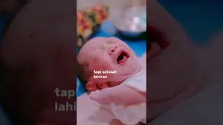 HAMPIR KEHILANGAN NYAWA SAAT LAHIRAN KARENA PREEKLAMSIA 