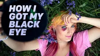These were almost THE LAST PHOTOS I EVER TOOK! How I got my black eye...