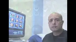 Doppler espectral: Velocidad de barrido. ¿Que es y como modificarlo?